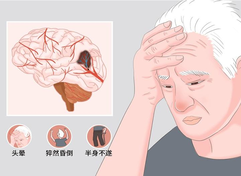 腦血管病與健康睡眠系統(tǒng)